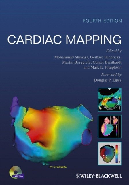 Cardiac Mapping, 4th Edition | Cardiac Mapping, 4th Edition