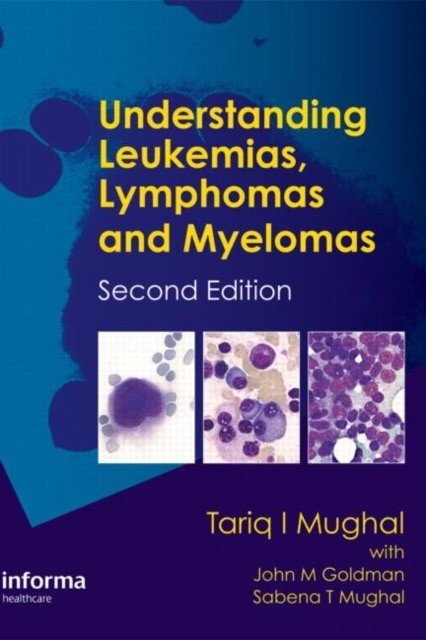 Understanding Leukemias, Lymphomas and Myelomas, Second Edition | Understanding Leukemias, Lymphomas, and Myelomas, Second Edition