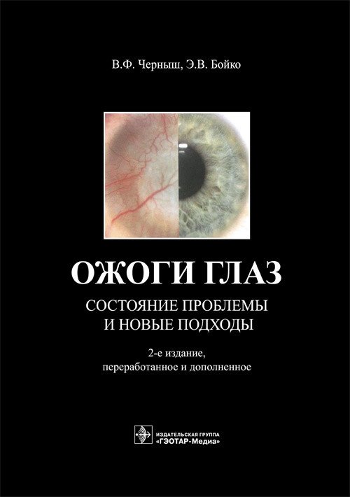Ожоги глаз. Состояние проблемы и новые подходы | Eye Burns: Problem Status and New Approaches