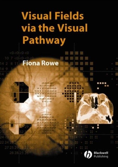 Visual Fields via the Visual Pathway | Visual Fields via the Visual Pathway