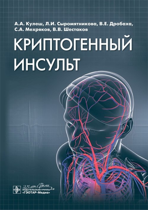 Криптогенный инсульт | Cryptogenic Stroke
