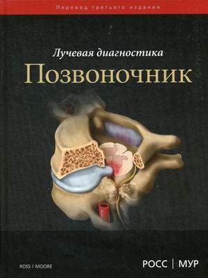 Лучевая диагностика. Позвоночник | Radiological Diagnostics: Spine