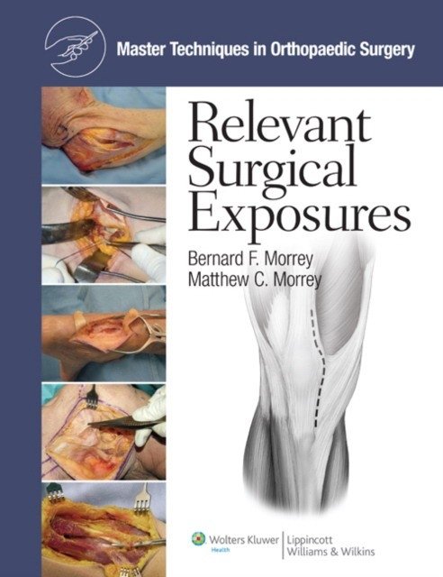 Master Techniques in Orthopaedic Surgery: Surgical Exposures | Master Techniques in Orthopaedic Surgery: Surgical Exposures