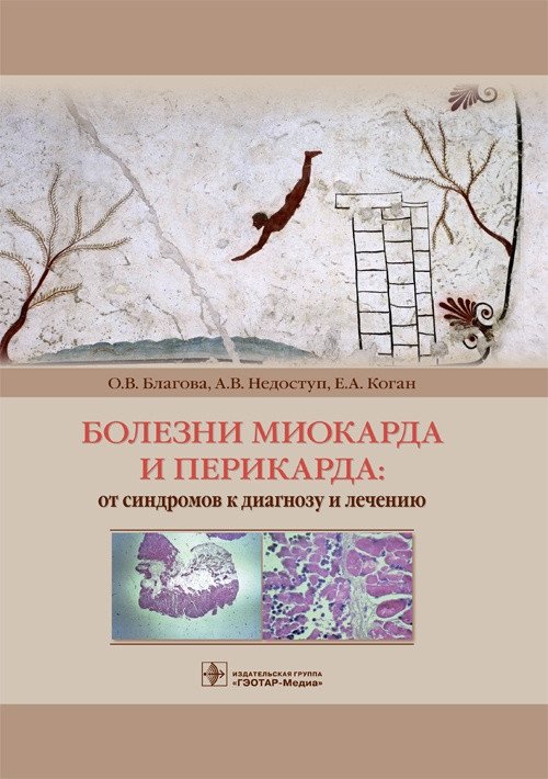 Болезни миокарда и перикарда. От синдромов к диагнозу и лечению | Myocardial and Pericardial Diseases: From Syndromes to Diagnosis and Treatment