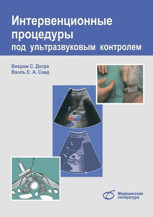 Интервенционные процедуры под ультразвуковым контролем | Ultrasound-Guided Interventional Procedures