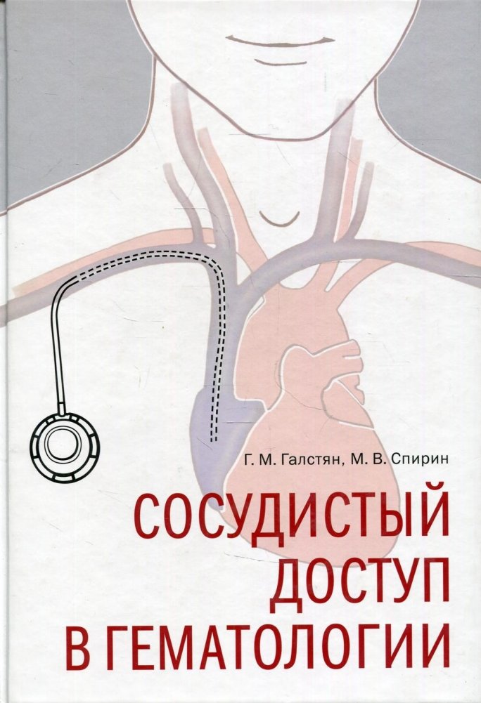Сосудистый доступ в гематологии | Vascular Access in Hematology