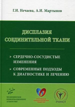 Дисплазия соединительной ткани. Сердечно-сосудистые изменения. Современные подходы к диагностике и лечению | Connective Tissue Dysplasia: Cardiovascular Changes. Modern Approaches to Diagnosis and Treatment