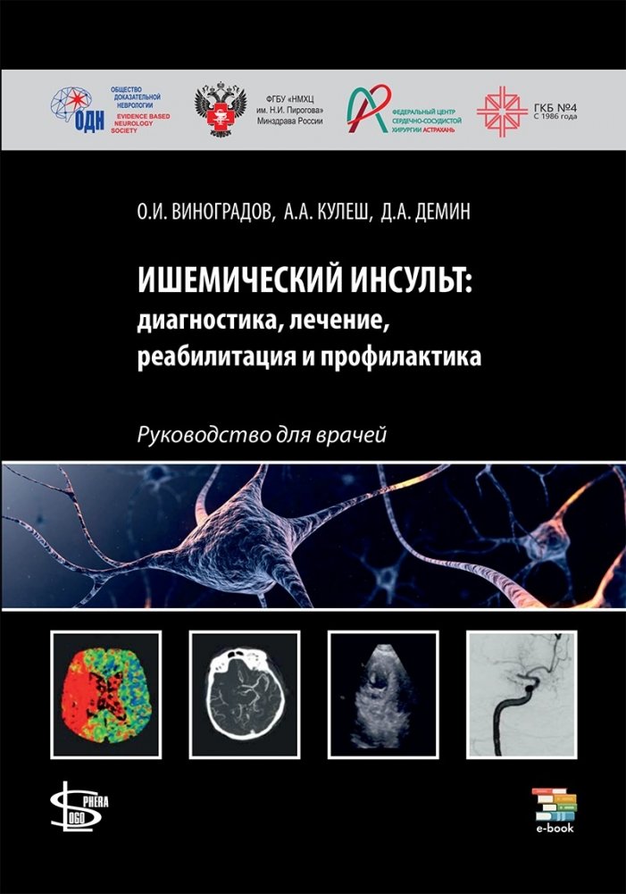 Ишемический инсульт: диагностика, лечение, реабилитация и профилактика. Руководство для врачей | Ischemic Stroke: Diagnosis, Treatment, Rehabilitation, and Prevention. A Guide for Physicians