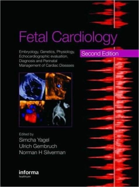 Fetal Cardiology: Embryology, Genetics, Physiology, Echocardiography Evaluation, Diagnosis and Perinatal Management of Cardiac Diseases | Fetal Cardiology: Embryology, Genetics, Physiology, Echocardiography Evaluation, Diagnosis and Perinatal Mana...