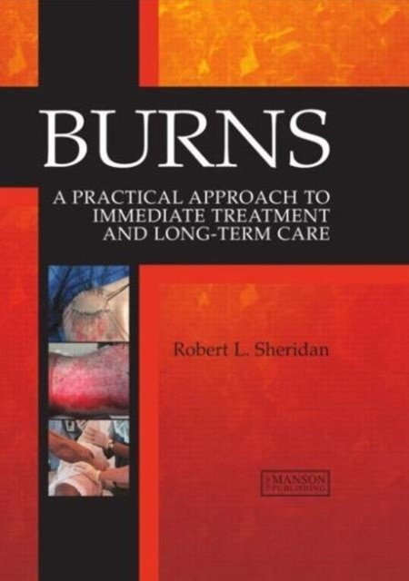 Burns - A Practical Approach | Burns: A Practical Approach