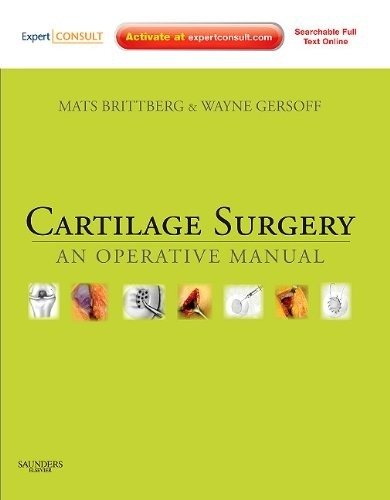 Хирургия хряща | Cartilage Surgery