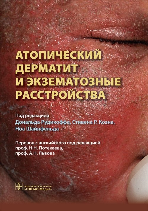 Атопический дерматит и экзематозные расстройства | Atopic Dermatitis and Eczematous Disorders