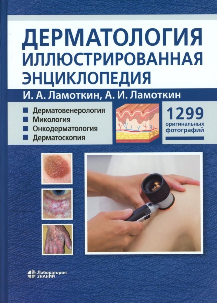 Дерматология. Иллюстрированная энциклопедия. Дерматовенерология. Микология. Онкодерматология. Дерматоскопия | Dermatology: An Illustrated Encyclopedia