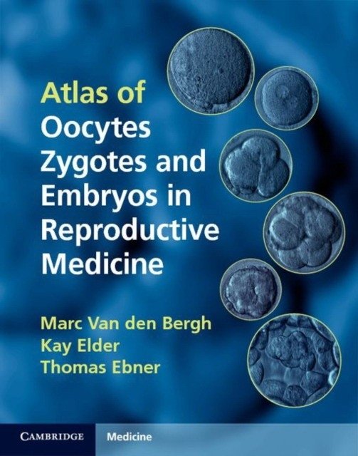 Atlas of Oocytes, Zygotes and Embryos in Reproductive Medicine Hardback with CD-ROM | Atlas of Oocytes, Zygotes, and Embryos in Reproductive Medicine