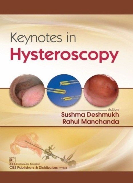 Keynotes In Hysteroscopy (Pb 2019) | Keynotes in Hysteroscopy