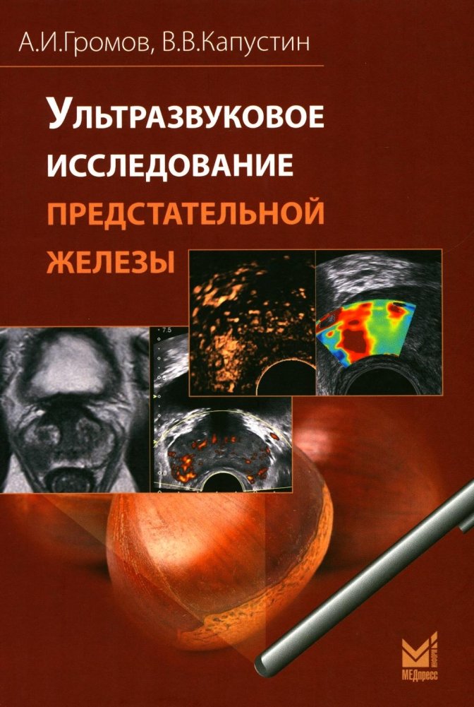 Ультразвуковое исследование предстательной железы | Ultrasound Examination of the Prostate Gland