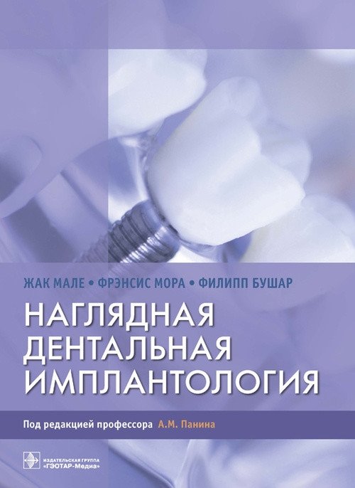 Наглядная дентальная имплантология | Visual Dental Implantology