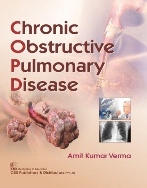 Chronic Obstructive Pulmonary Disease (Pb 2019) | Chronic Obstructive Pulmonary Disease (2019)