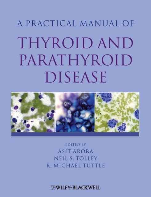 Practical Manual of Thyroid and Parathyroid Disease | Practical Manual of Thyroid and Parathyroid Disease