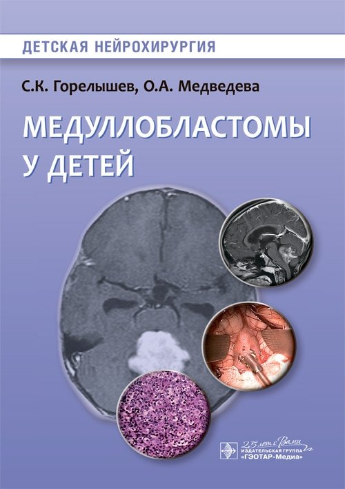 Медуллобластомы у детей | Medulloblastomas in Children