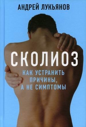 Сколиоз. Как устранить причины, а не симптомы | Scoliosis: Addressing Causes, Not Just Symptoms
