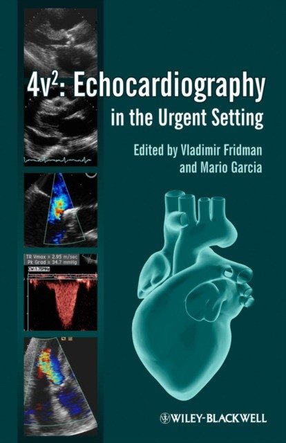 Практическое руководство по эхокардиографии в неотложной ситуации | Practical Manual of Echocardiography in the Urgent Setting