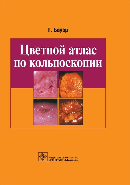 Цветной атлас по кольпоскопии | Color Atlas of Colposcopy