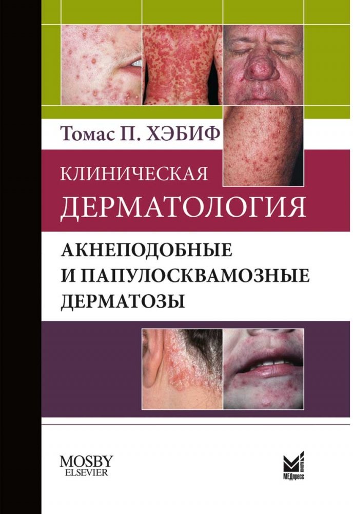 Клиническая дерматология. Акнеподобные и папулосквамозные дерматозы | Clinical Dermatology: Acneiform and Papulosquamous Dermatoses