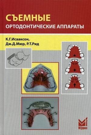 Съемные ортодонтические аппараты | Removable Orthodontic Appliances