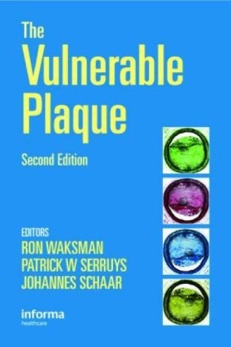 The Vulnerable Plaque, 2E | The Vulnerable Plaque, 2nd Edition