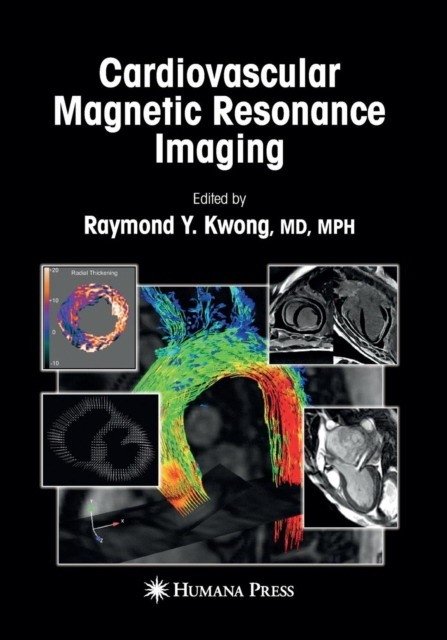 Cardiovascular Magnetic Resonance Imaging | Cardiovascular Magnetic Resonance Imaging