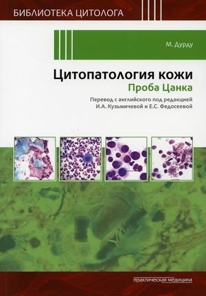 Цитопатология кожи. Проба Цанка | Cytopathology of the Skin. Tzanck Smear