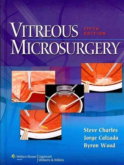 Vitreous Microsurgery | Vitreous Microsurgery