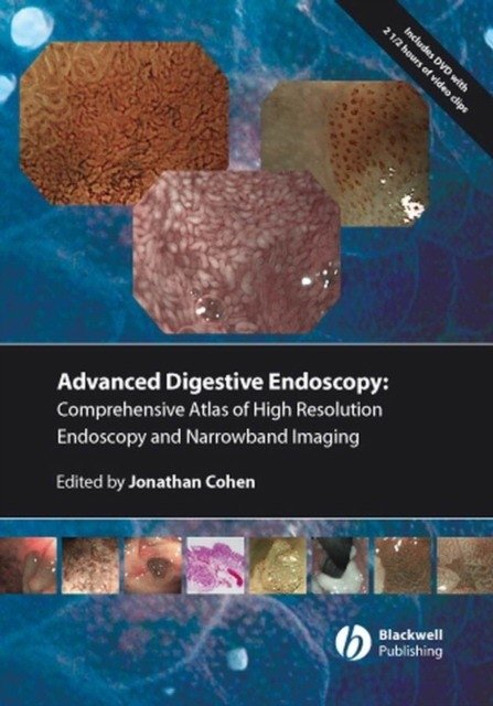Advanced Digestive Endoscopy - Comprehensive Atlas of High Resolution Endoscopy and Narrowband Imaging | Advanced Digestive Endoscopy: A Comprehensive Atlas of High-Resolution Endoscopy and Narrowband Imaging