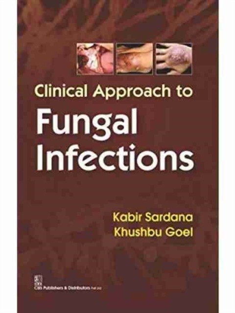 Clinical Approach To Fungal Infections (Pb 2016) | Clinical Approach to Fungal Infections