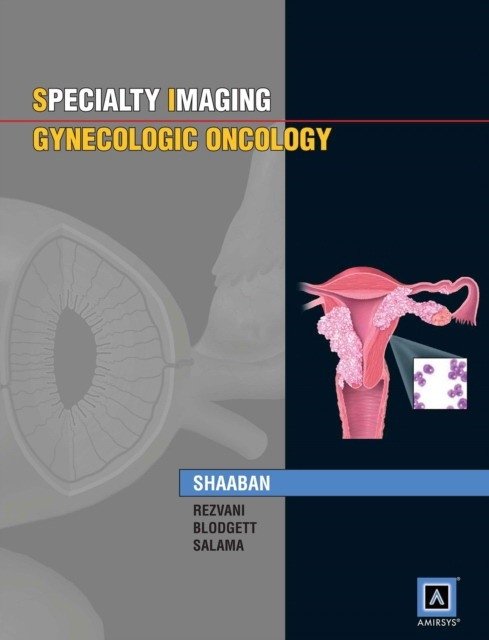 Specialty Imaging™: Gynecologic Oncology | Specialty Imaging: Gynecologic Oncology