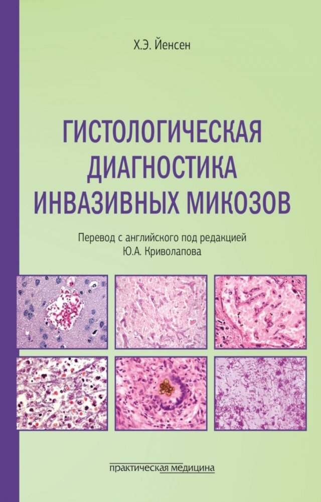 Гистологическая диагностика инвазивных микозов | Histological Diagnosis of Invasive Mycoses
