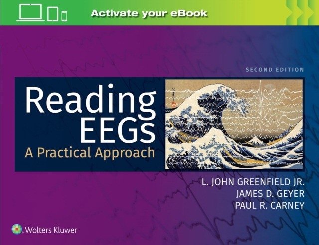 Reading EEGs: A Practical Approach, 2 ed | Reading EEGs: A Practical Approach, 2nd Edition