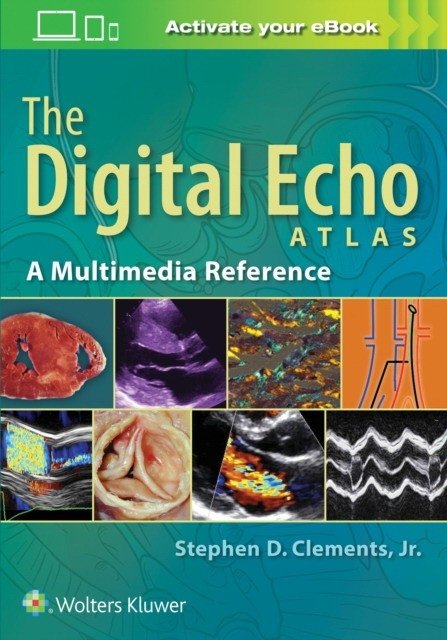 Digital echo atlas | Digital Echo Atlas
