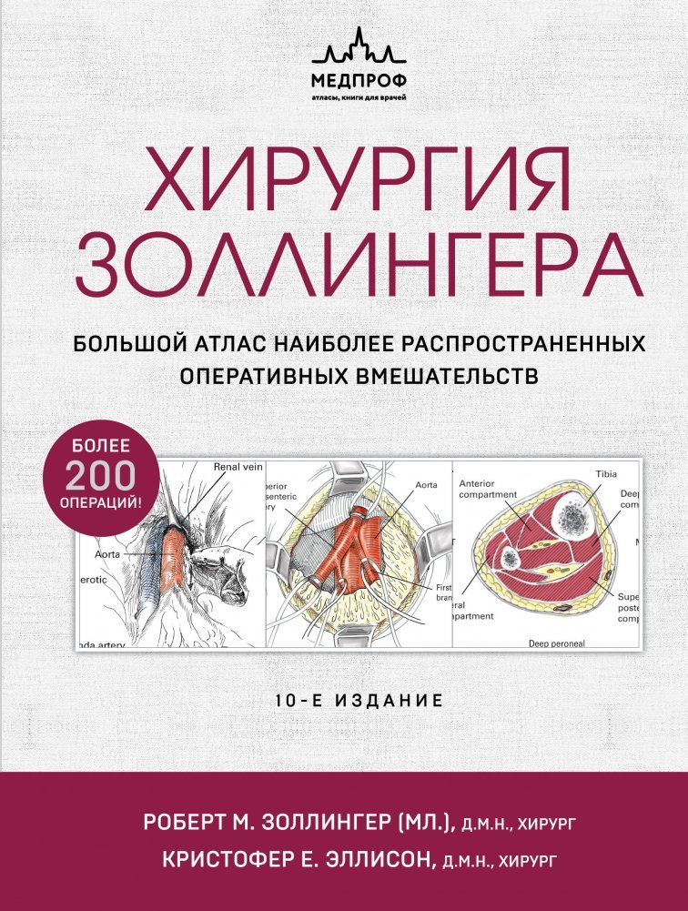 Хирургия Золлингера. Большой атлас наиболее распространенных оперативных вмешательств | Zollinger's Surgery: A Comprehensive Atlas of Common Operative Interventions