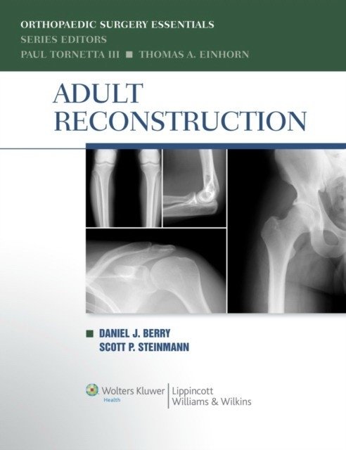Adult Reconstruction | Adult Reconstruction