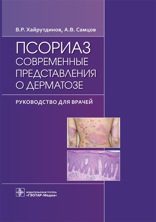 Псориаз. Современные представления о дерматозе | Psoriasis: Modern Understanding of the Dermatosis