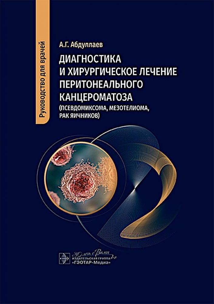 Диагностика и хирургическое лечение перитонеального канцероматоза (псевдомиксома, мезотелиома, рак яичников) | Diagnosis and Surgical Treatment of Peritoneal Carcinomatosis (Pseudomyxoma, Mesothelioma, Ovarian Cancer)