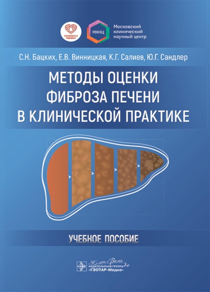 Методы оценки фиброза печени в клинической практике: Учебное пособие | Methods for Assessing Liver Fibrosis in Clinical Practice: A Study Guide