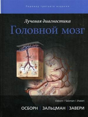 Лучевая диагностика. Головной мозг | Radiological Diagnostics: Brain