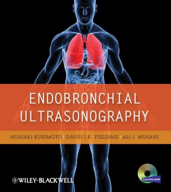 Эндоскопическая ультрасонография | Endobronchial Ultrasonography