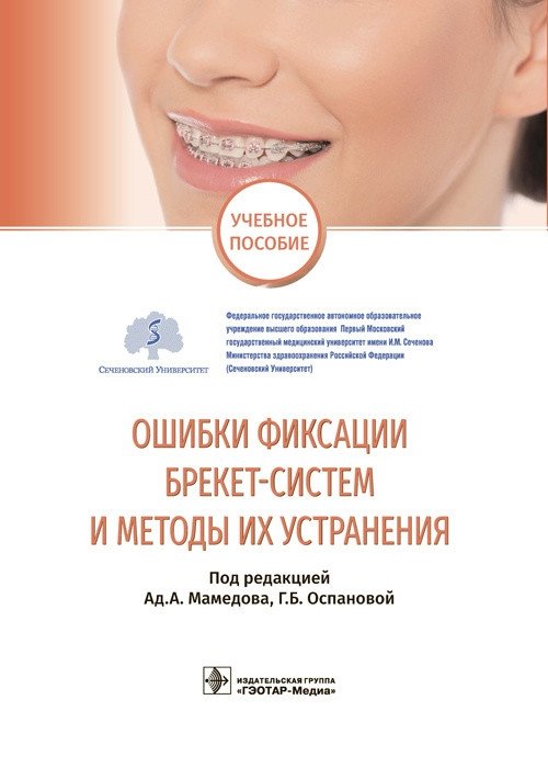 Ошибки фиксации брекет-систем и методы их устранения | Bracket System Fixation Errors and Their Elimination Methods