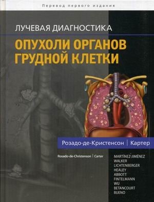 Лучевая диагностика. Опухоли органов грудной клетки | Diagnostic Imaging: Tumors of the Thoracic Organs