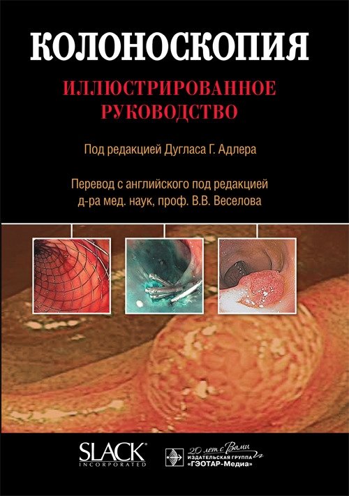 Колоноскопия | Colonoscopy