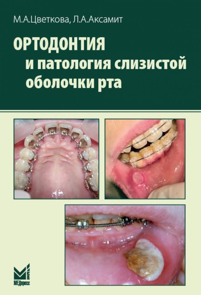Ортодонтия и патология слизистой оболочки рта | Orthodontics and Oral Mucosa Pathology